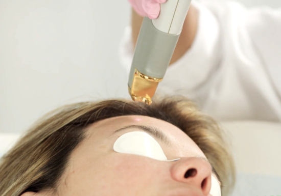 Laser Genesis+ Treatment